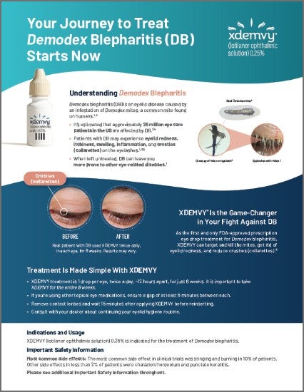 thumbnail image of xdemvy quick start guide